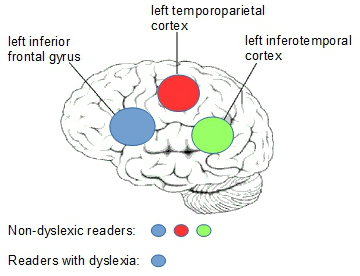 brain diagram